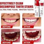 Yayashi SP-4 Ultra Whitening Toothpaste | Stain Remover & Fresh Breath Formula