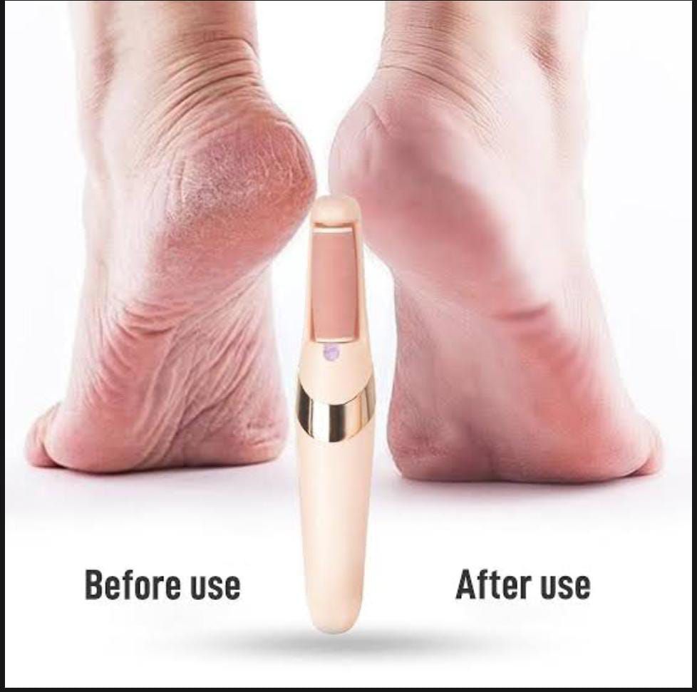 Rechargeable Pedi Foot Filer Effective Callus Remover For Soft Smooth Feet - NextGenzVolt