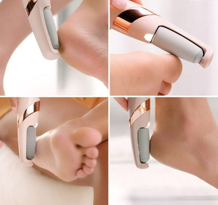Rechargeable Pedi Foot Filer Effective Callus Remover For Soft Smooth Feet - NextGenzVolt