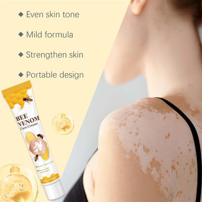 Vitigo Bee Venom Treatment Cream | Natural Skin Repair Hydration Relief Anti-Irritation